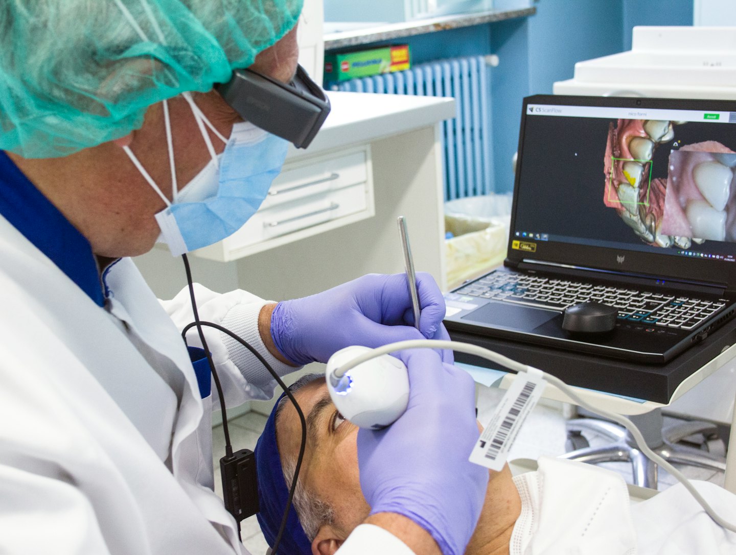 Dentista usa scanner intraorale per creare modello 3D del dente.