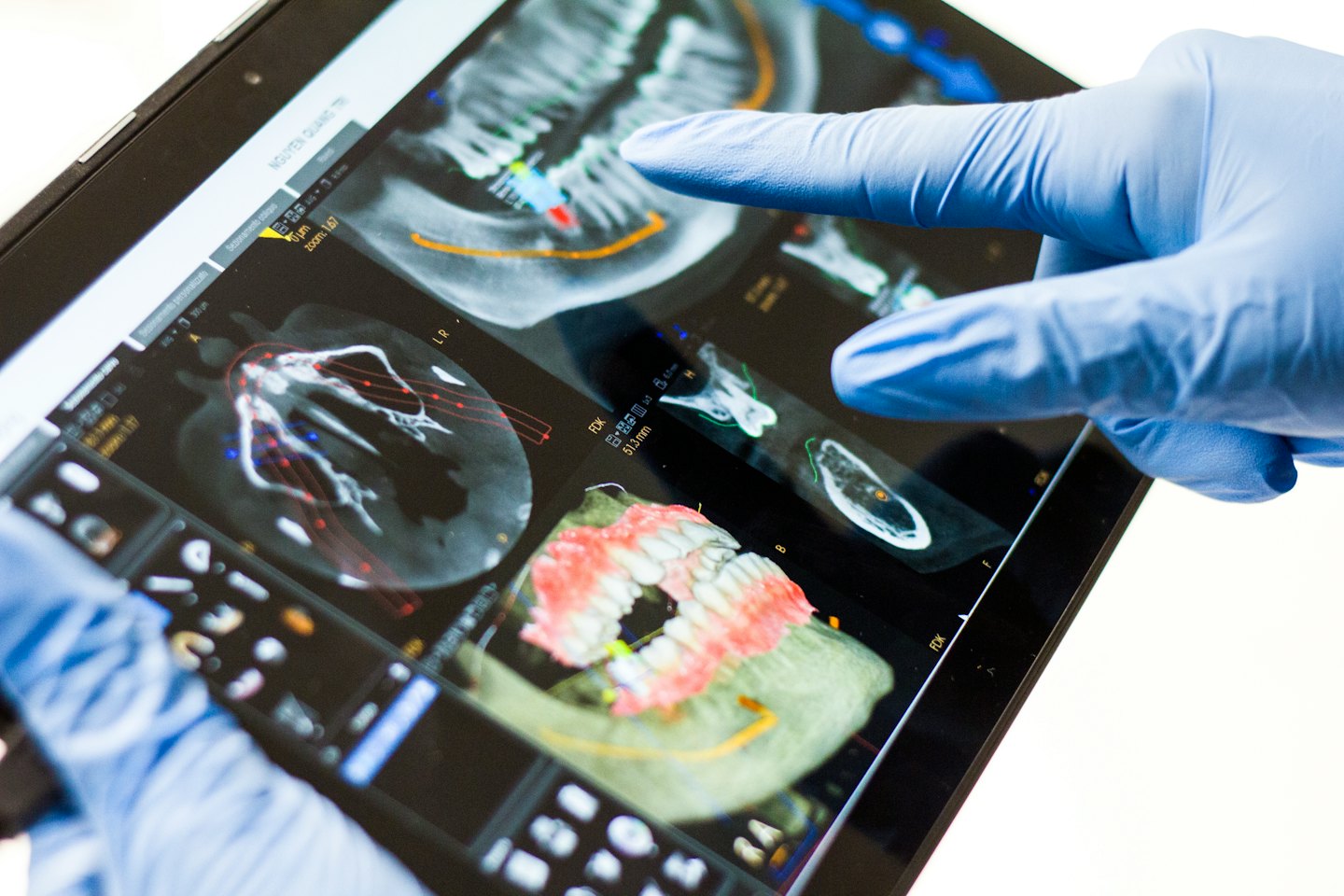 Dentista che esamina una scansione 3D della mascella su un tablet.